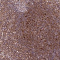 Anti-SH3BGRL antibody produced in rabbit 