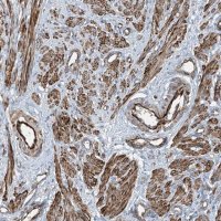 Anti-SH3BGRL3 antibody produced in rabbit 