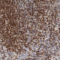 Anti-SH3BP1 antibody produced in rabbit 