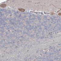 Anti-SH3BP5L antibody produced in rabbit 