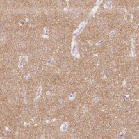 Anti-SH3GL2 antibody produced in rabbit 