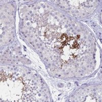 Anti-SH3GL3 antibody produced in rabbit 