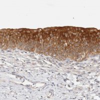 Anti-SH3GLB2 antibody produced in rabbit 