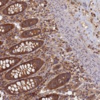Anti-SHARPIN antibody produced in rabbit 