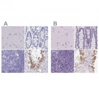 Anti-SHCBP1L antibody produced in rabbit 