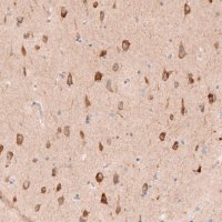 Anti-SHOC2 antibody produced in rabbit 