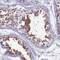 Anti-SKA3 antibody produced in rabbit 
