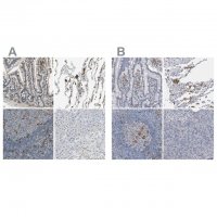 Anti-SKAP2 antibody produced in rabbit HPA005560-100UL