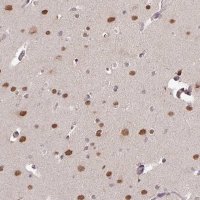 Anti-SKIV2L antibody produced in rabbit HPA051959-100UL