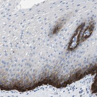 Anti-SLC10A6 antibody produced in rabbit 