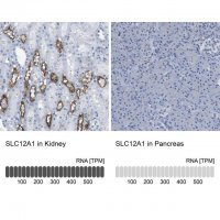 Anti-SLC12A1 antibody produced in rabbit 