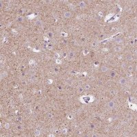 Anti-SLC12A5 antibody produced in rabbit 