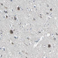 Anti-SLC16A7 antibody produced in rabbit 
