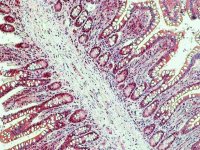Anti-SLC1A1 antibody produced in rabbit SAB4200518-200UL