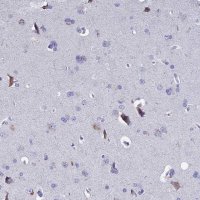 Anti-SLC1A6 antibody produced in rabbit 