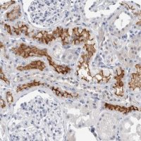 Anti-SLC22A12 antibody produced in rabbit 
