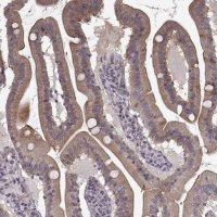 Anti-SLC22A18 antibody produced in rabbit 
