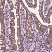 Anti-SLC22A18AS antibody produced in rabbit 