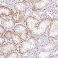 Anti-SLC22A8 antibody produced in rabbit 