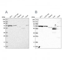 Anti-SLC25A12 antibody produced in rabbit 