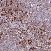 Anti-SLC25A16 antibody produced in rabbit HPA044580-100UL