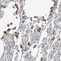 Anti-SLC25A20 antibody produced in rabbit 