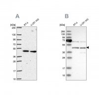 Anti-SLC25A24 antibody produced in rabbit 