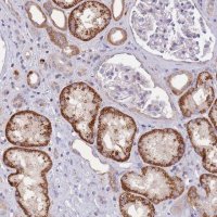 Anti-SLC25A42 antibody produced in rabbit 