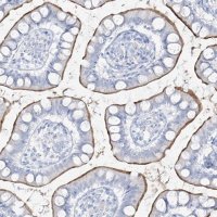 Anti-SLC26A3 antibody produced in rabbit 