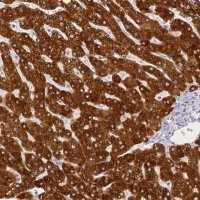 Anti-SLC27A5 antibody produced in rabbit 