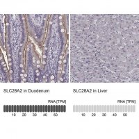 Anti-SLC28A2 antibody produced in rabbit 