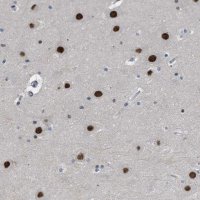 Anti-SLC29A2 antibody produced in rabbit 