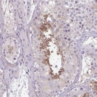 Anti-SLC30A3 antibody produced in rabbit 