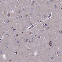 Anti-SLC33A1 antibody produced in rabbit 
