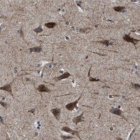 Anti-SLC35F1 antibody produced in rabbit 