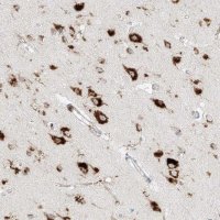 Anti-SLC35F6 antibody produced in rabbit 