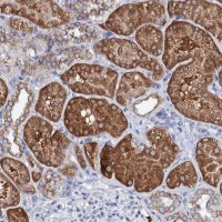 Anti-SLC37A4 antibody produced in rabbit 