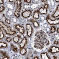 Anti-SLC47A1 antibody produced in rabbit 