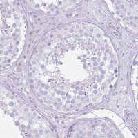 Anti-SLC4A4 antibody produced in rabbit 