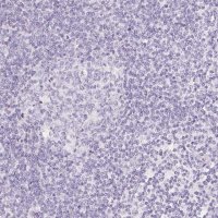 Anti-SLC5A2 antibody produced in rabbit 