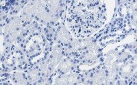 Anti-SLC5A2 Antibody, clone 2I4 ZooMAb Rabbit Monoclonal 