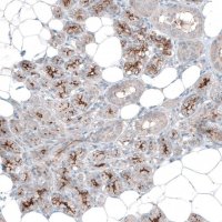 Anti-SLC6A14 antibody produced in rabbit 