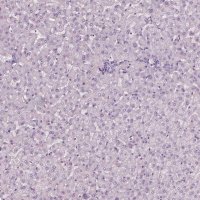 Anti-SLC6A17 antibody produced in rabbit 