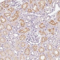 Anti-SLC6A18 antibody produced in rabbit 