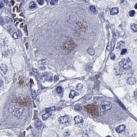 Anti-SLC6A2 