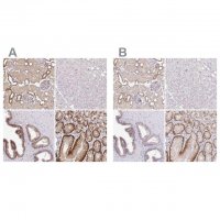 Anti-SLC9A1 antibody produced in rabbit 