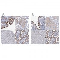 Anti-SLC9A3 antibody produced in rabbit 