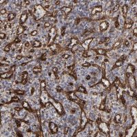 Anti-SLC9A3R2 antibody produced in rabbit 