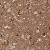 Anti-SLC9A6 antibody produced in rabbit 