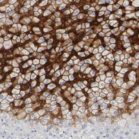 Anti-SLCO1B3 antibody produced in rabbit 